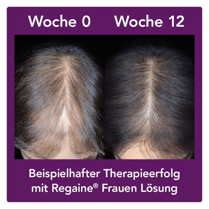 Regaine Frauen Lösung, 60 ml Lösung