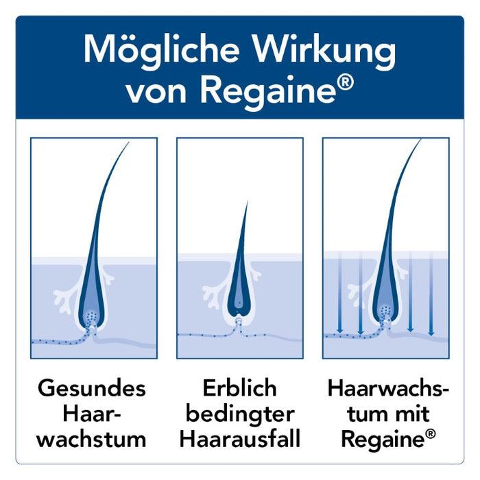 Regaine Männer Lösung, 180 ml Solution